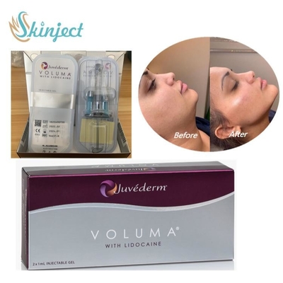 Ácido hialurónico del llenador cutáneo de Juvederm Voluma para la mejilla facial Chin Contour