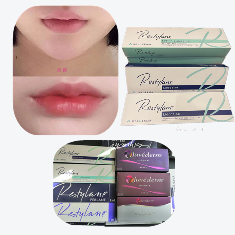 Ácido hialurónico cruzado, rellenos dérmicos y productos antienvejecimiento