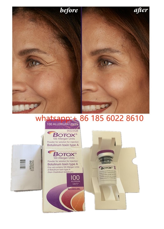 Productos de belleza Allergan 100 unidades Toxina botulínica  para arrugas faciales Relleno cutáneo