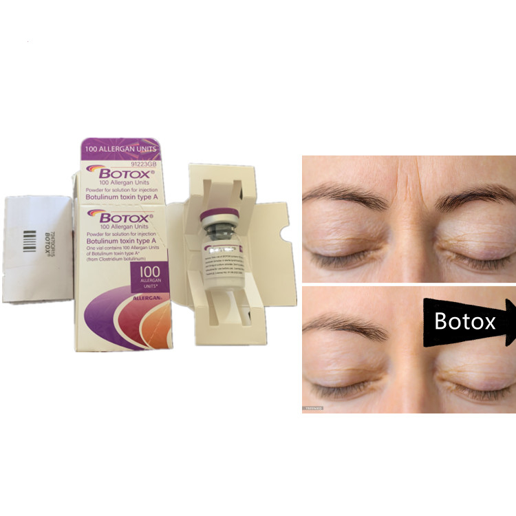 Allergan 100ui Sero de Toxina Botulínica Antienvejecimiento Producto para Disportes Faciales