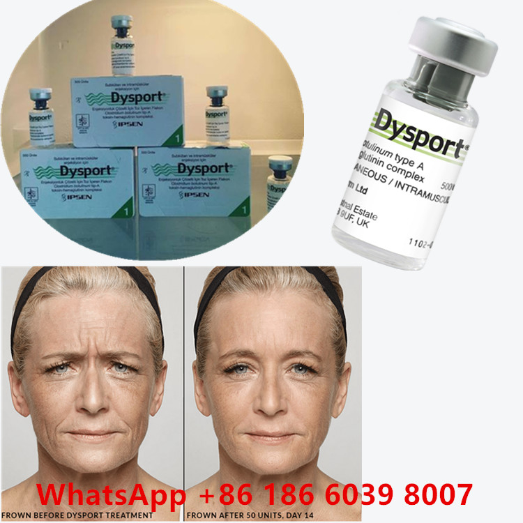 Toxina botulínica 100 unidades BTX inyección tipo A Uso cosmético