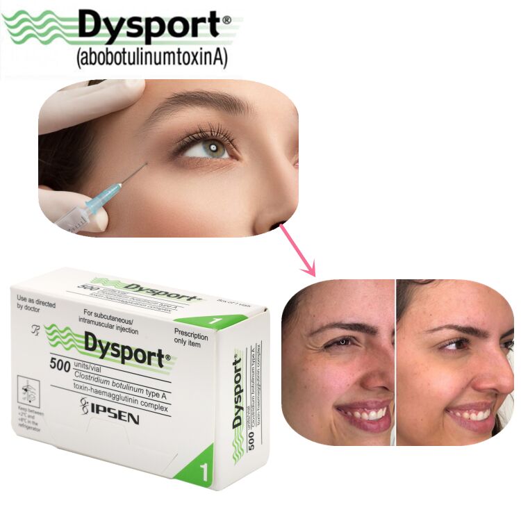 500u Dysport Disparición de Arrugas Faciales Polvo Liofilizado Procesamiento Personalizado OEM Dysport