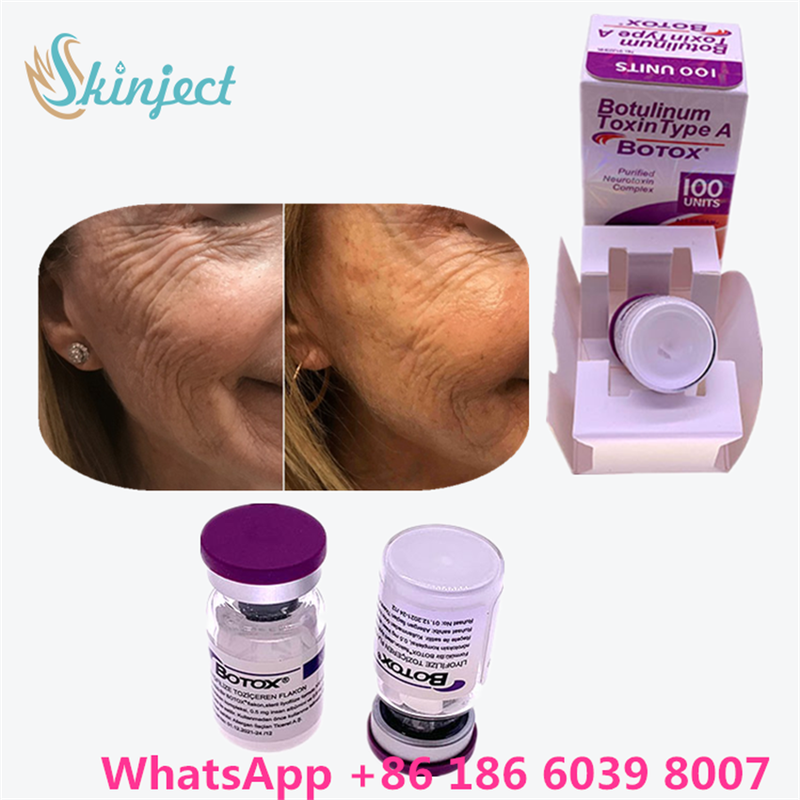 Toxina Botulínica Allergan Botox Polvo Blanco Tratamiento Efectivo para Líneas Faciales y Relajación Muscular en Medicina