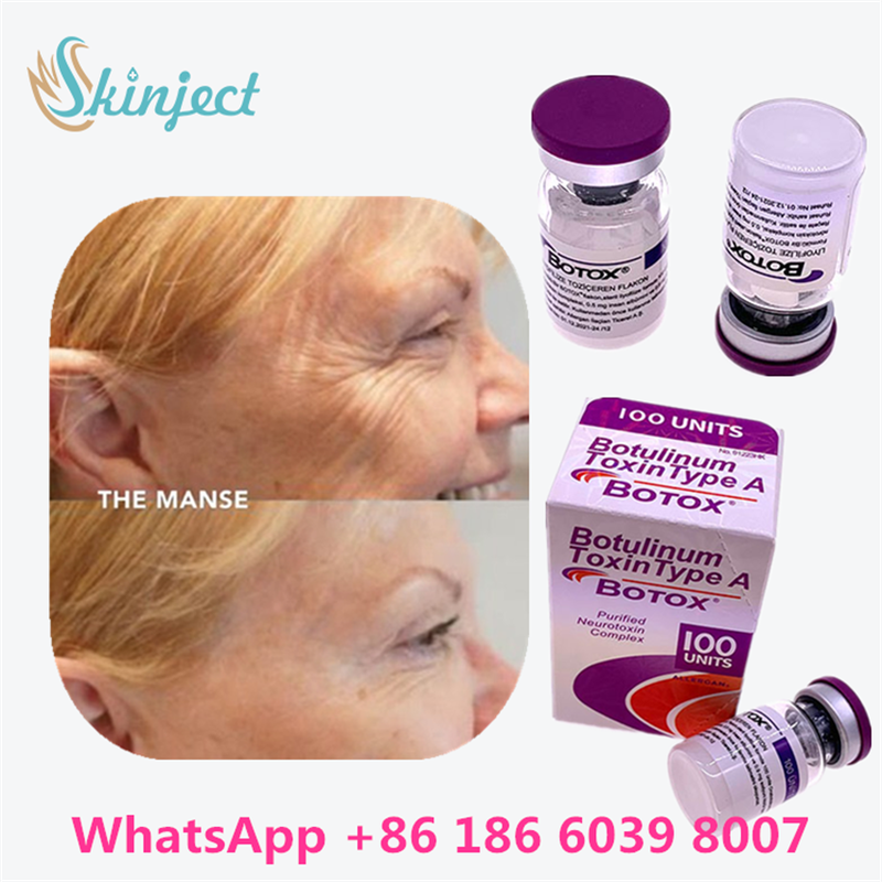 Toxina Botulínica BOTOX Cosmético 100 Unidades Allergan OnabotulinumtoxinA para Arrugas Faciales
