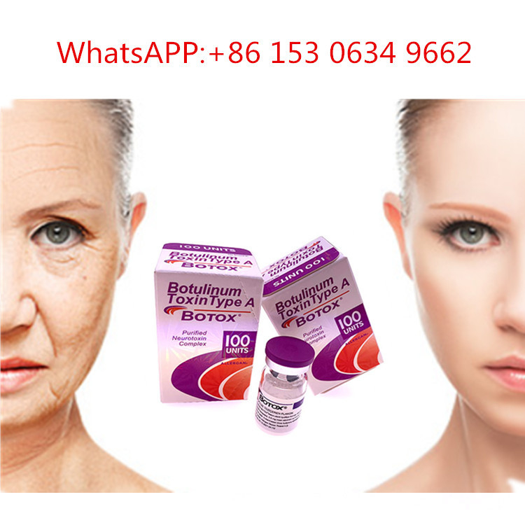 tipo de 50u 100u 150u una toxina Botulinum de la inyección de Allergan  para la arruga anti