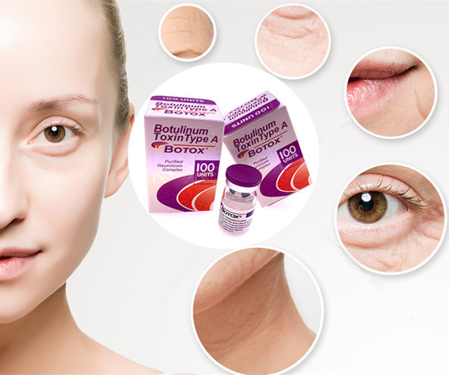 Tipo de la toxina de Botuliunm de las unidades de Meditoion 50 100 unidades Allergan