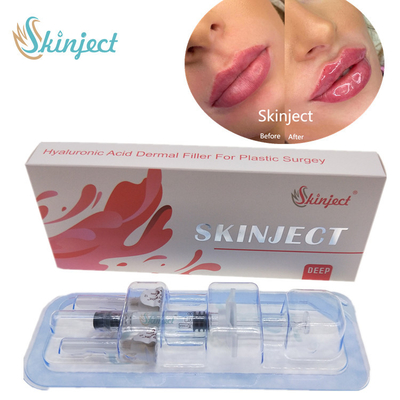 Llenadores cutáneos ácidos hialurónicos profundos de los labios 2ml de Skinject inyectables