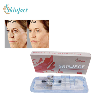 Llenador cutáneo del labio de la inyección para las arrugas y los dobleces faciales profundos