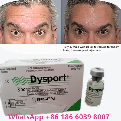 Toxina Botulínica  en Polvo Dysport 100 IU/1 vial para el Envejecimiento de la Piel