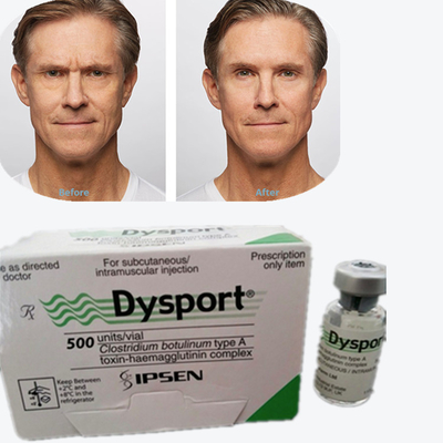 Toxina Botulínica Dysport 100 UI Toxina Botulínica Tipo A para la eliminación de arrugas