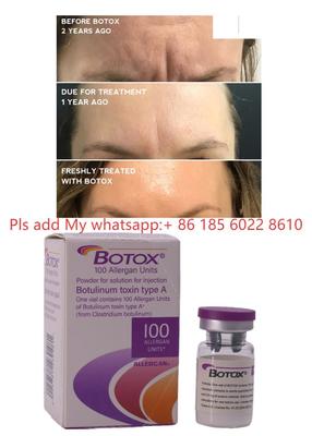 Inyección de Botox Allergan Botulax Toxina Botulínica Eliminar Arrugas