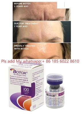Allergan Botox 100UI Dysport Inyección Toxina Botulínica Botulax Eliminar Arrugas