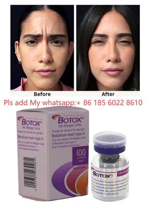 Toxina Botulínica Allergan Botox 100UI Inyección - Reduce los Signos de Envejecimiento con Allergan